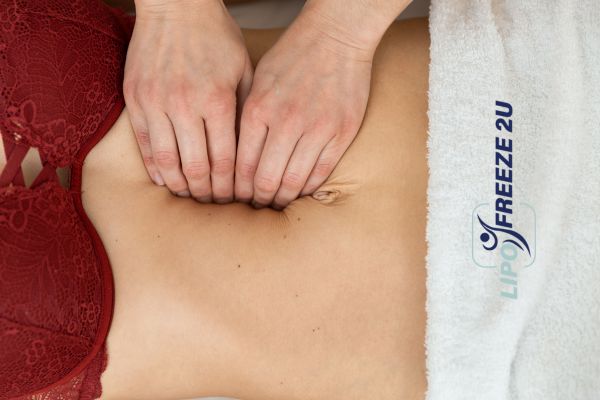 diastasis recti treatment Sandwich
