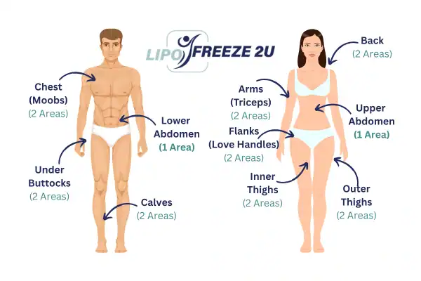 Areas you can have fat freezing treatment Sandwich