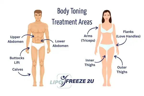 Graphic showing where you can have Body toning Treatment Sandwich on your body