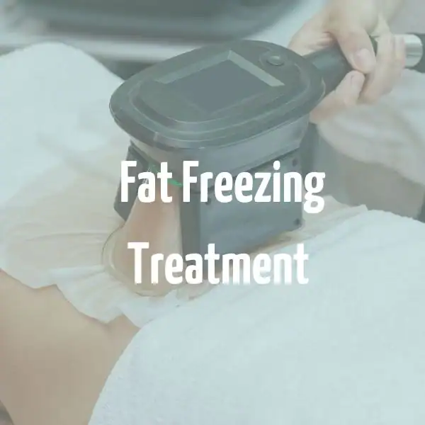 fat freezing treatment Sandwich