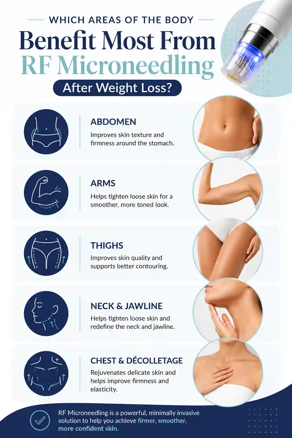 Which Areas of the Body Benefit Most From RF Microneedling After Weight Loss Sandwich